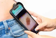 Do AI skin cancer detection devices meet clinical threshold? meta-analytics assessment across skin tones and data environment