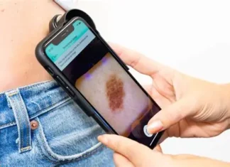 Do AI skin cancer detection devices meet clinical threshold? meta-analytics assessment across skin tones and data environment